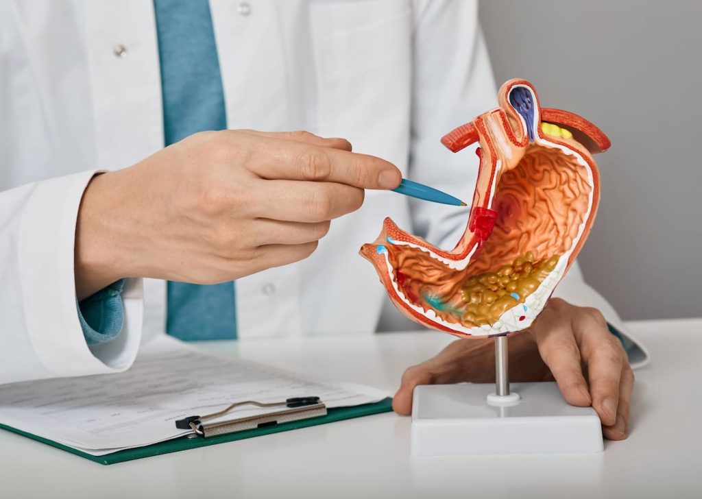 turkiye gastroenterology treatment procedure - Policlínico Magnus Medic